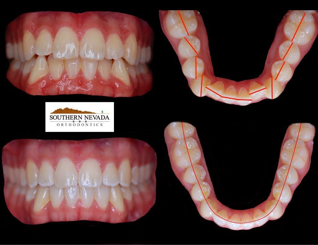 Southern Nevada Orthodontics gallery image