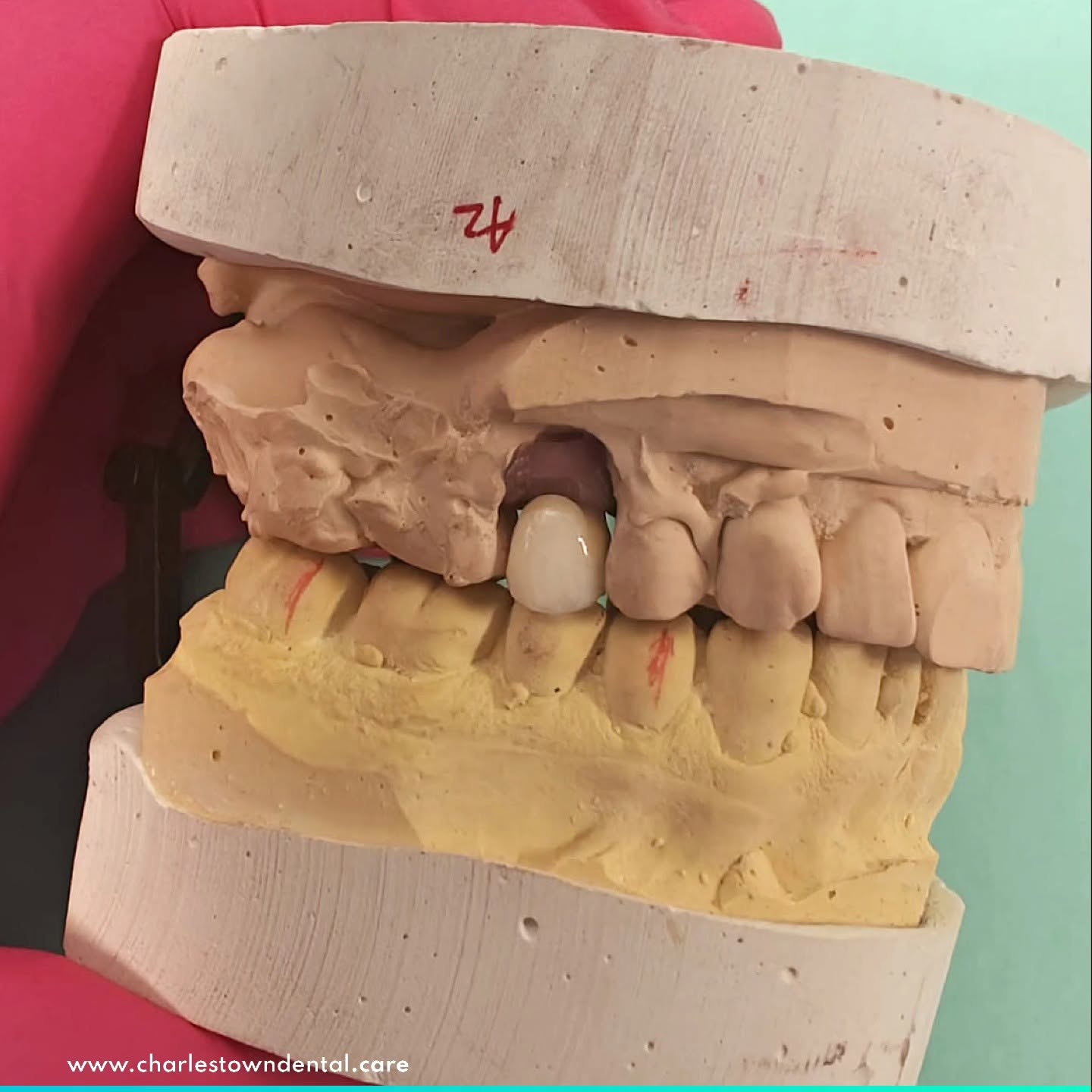 Charlestown Dental Care gallery image