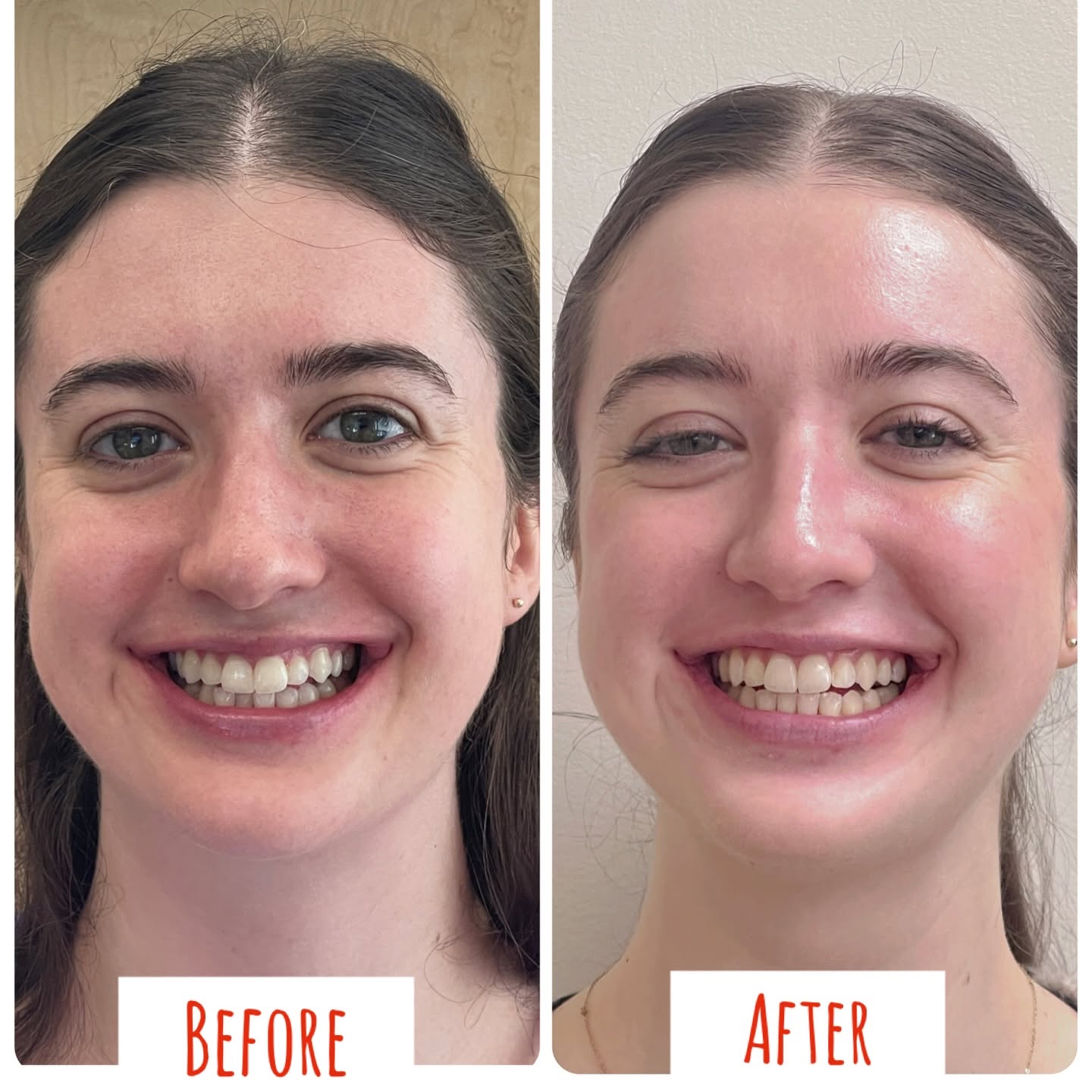 Prudential Dental Associates gallery image