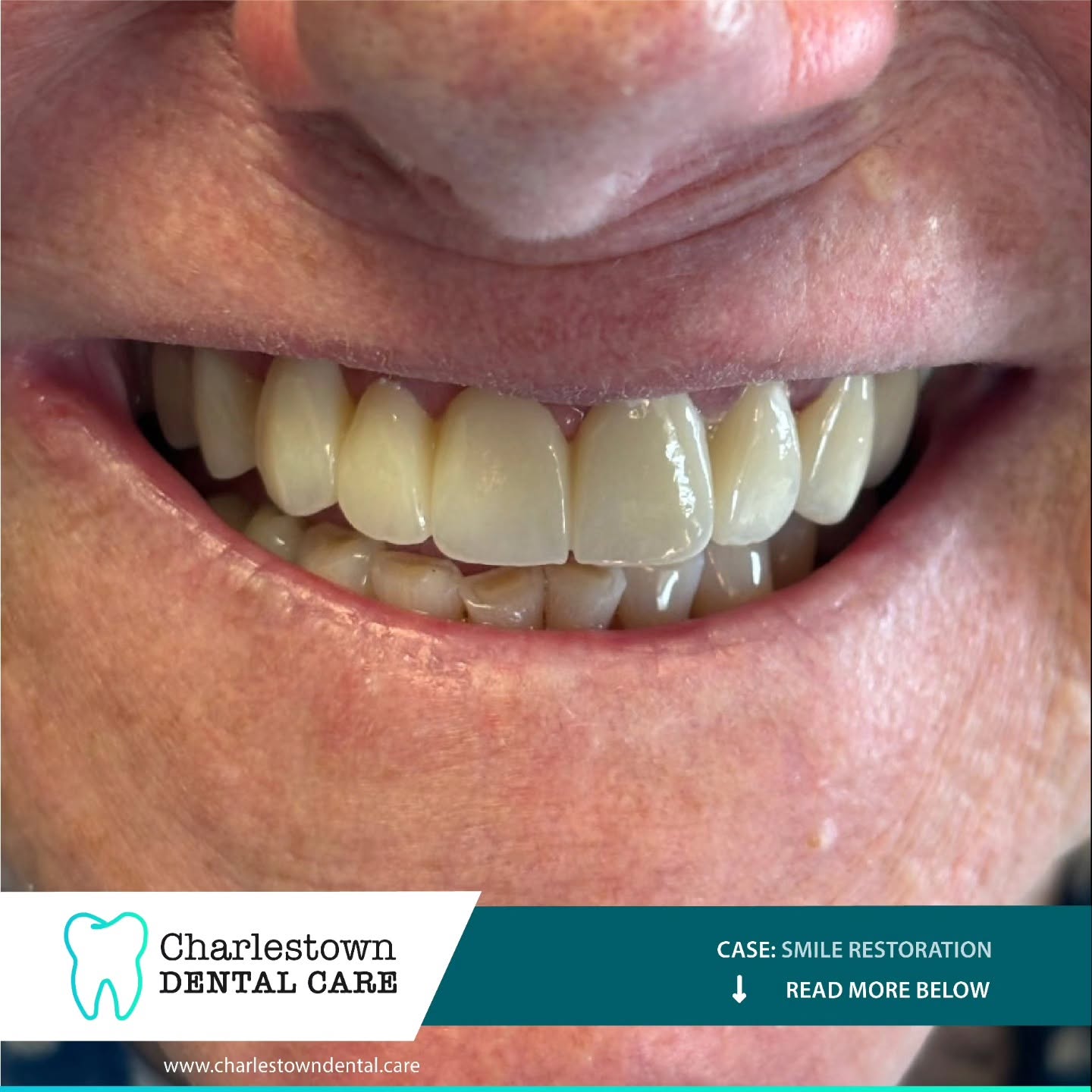 Charlestown Dental Care gallery image