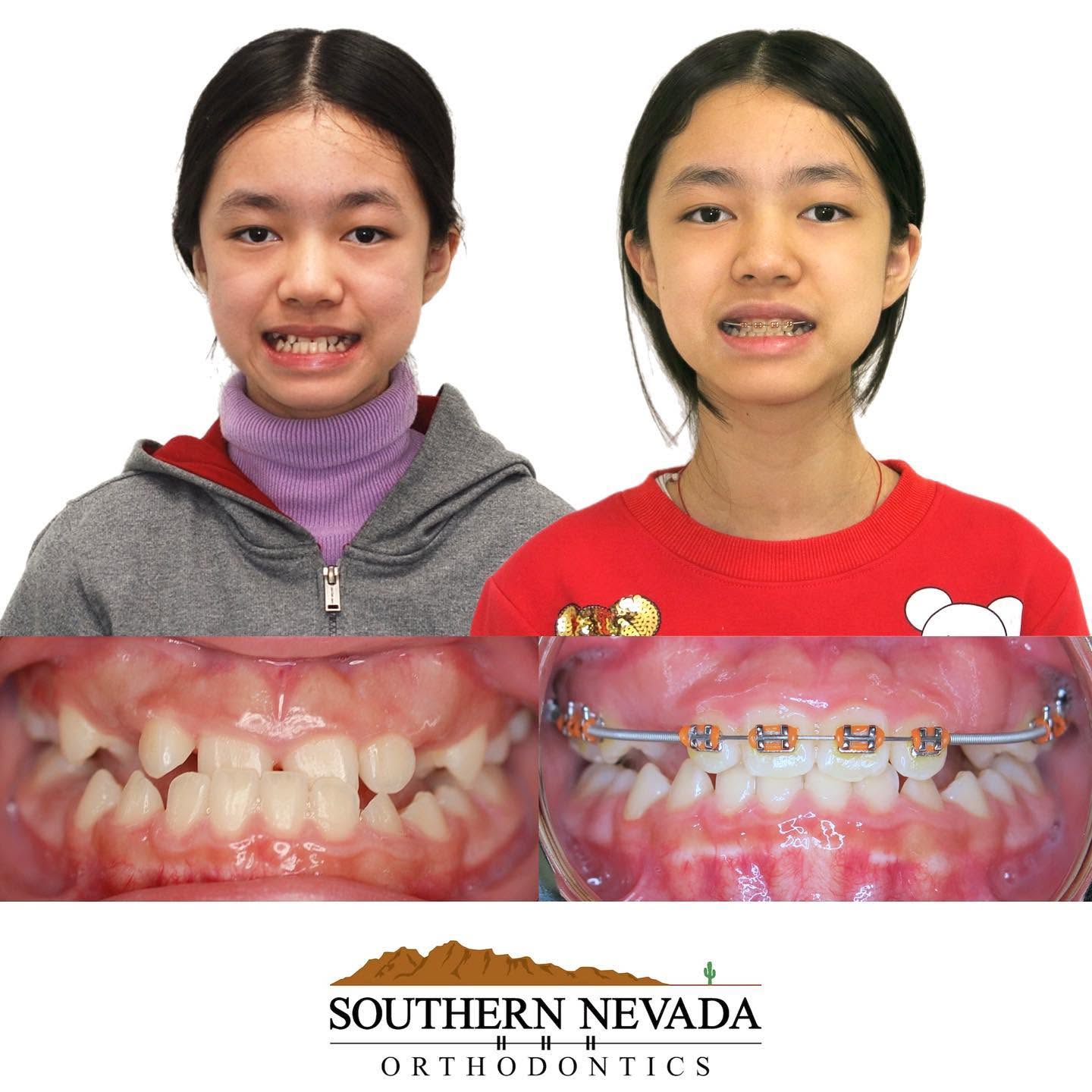 Southern Nevada Orthodontics gallery image